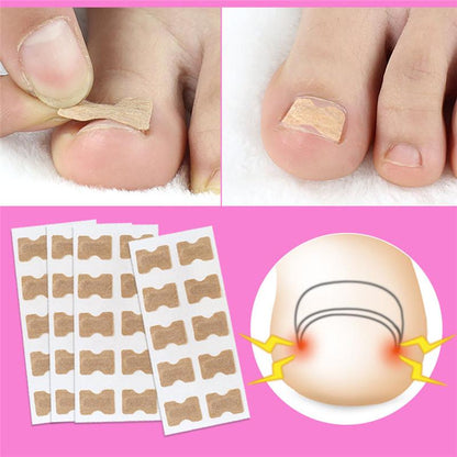PARCHES CORRECTORES DE UÑAS ⭐⭐⭐⭐⭐
